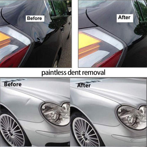 Kit de eliminación de abolladuras sin pintura, herramientas de reparación de carrocería sin pintura, reparación de abolladuras para automóviles, refrigeradores, carrocerías de motocicletas (B)